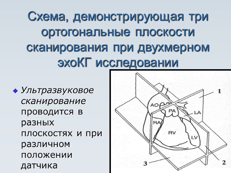 Схема, демонстрирующая три ортогональные плоскости сканирования при двухмерном эхоКГ исследовании   Ультразвуковое сканирование